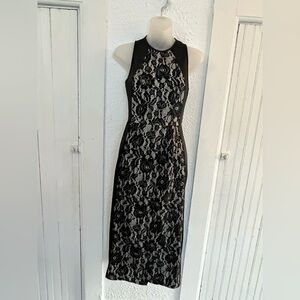 Elegant Black and White Lace Dress